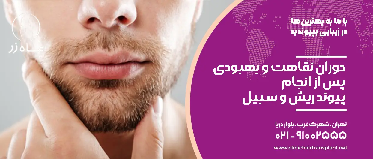 دوران نقاهت و بهبودی پس از انجام پیوند ریش و سبیل