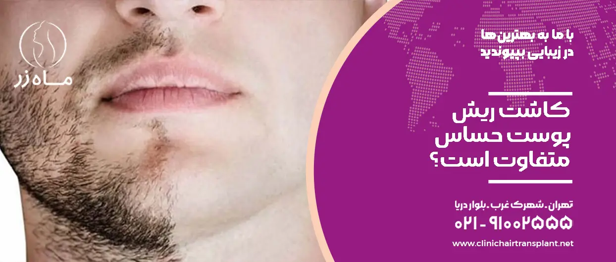 عوارض کاشت ریش پوست حساس