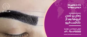 زمان پر شدن ابروها بعد از کاشت