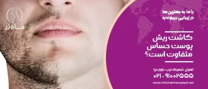 عوارض کاشت ریش پوست حساس