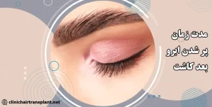 مدت زمان پر شدن کامل ابروها بعد از کاشت