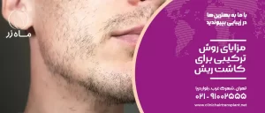 مزایای روش ترکیبی کاشت ریش