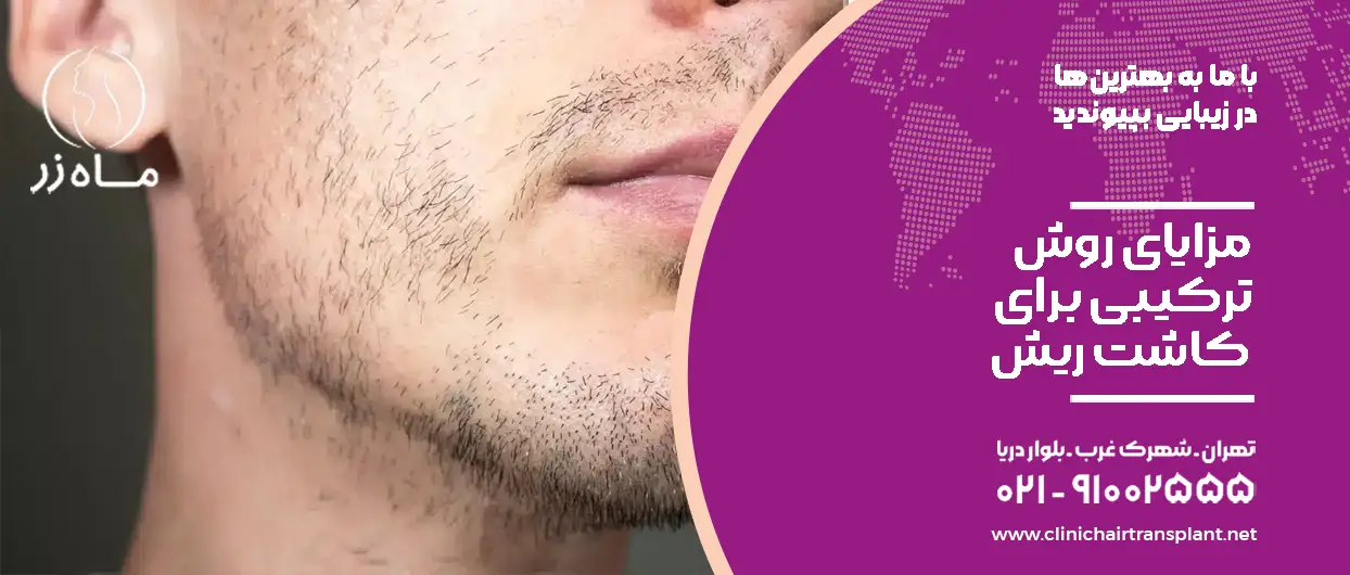 مزایای روش ترکیبی کاشت ریش