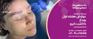 عوارض هفته اول کاشت ابرو