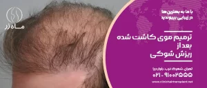 ترمیم بعد ریزش شوکی