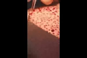 ترمیم-موهای-کاشته-شده-بعد-از-ریزش-شوک-poster