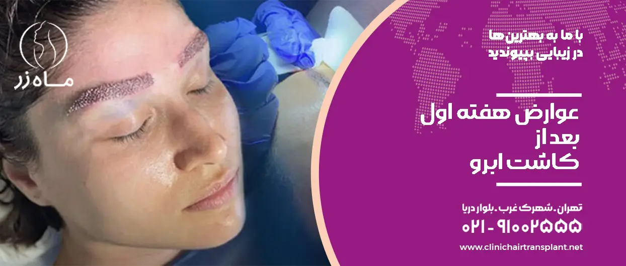 عوارض هفته اول کاشت ابرو