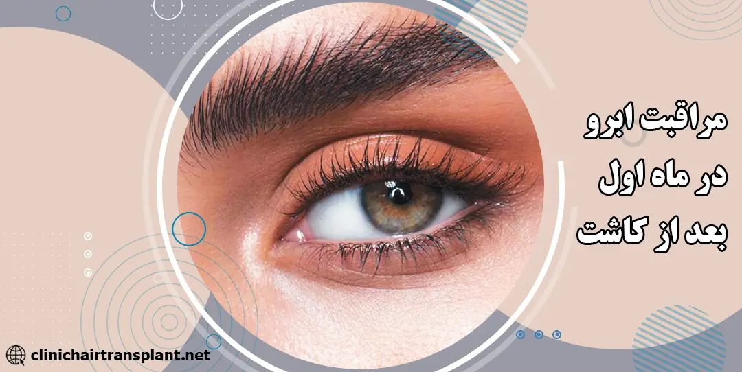 مراقبت از ابرو در ماه اول بعد از کاشت