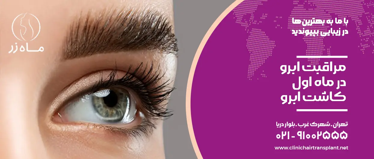 مراقبت ماه اول کاشت ابرو