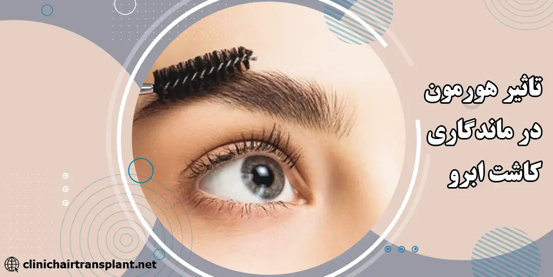 تاثیر هورمون‌ها روی ماندگاری کاشت ابرو