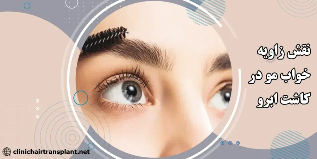 نقش زاویه خواب مو در طبیعی شدن ابروی کاشته‌شده