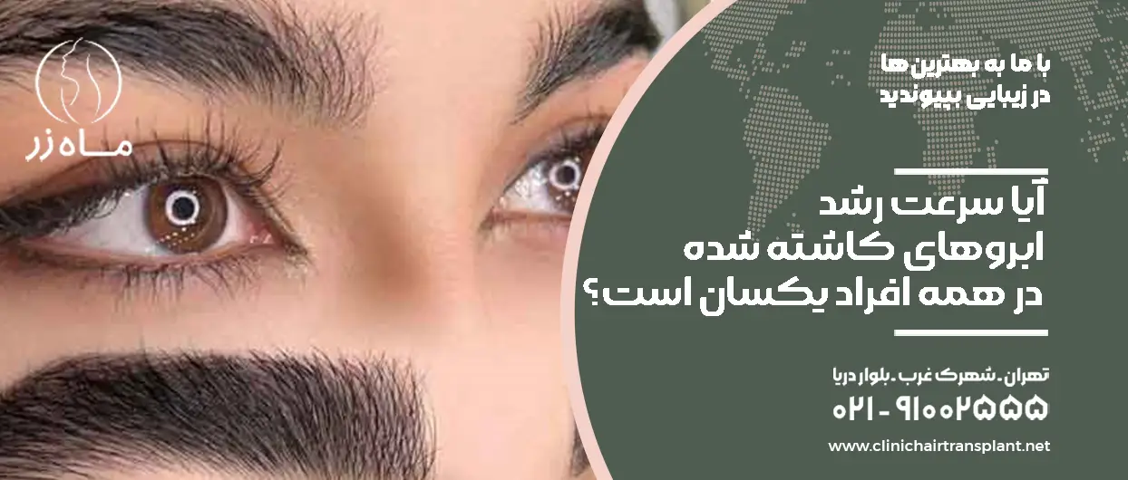 آیا سرعت رشد ابروهای کاشته شده در همه افراد یکسان است؟