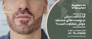 آیا کاشت ریش در پوست‌های مستعد جوش متفاوت است؟