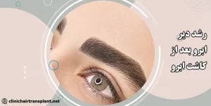 رشد دیر ابرو بعد از کاشت