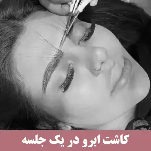 کاشت ابرو در یک جلسه
