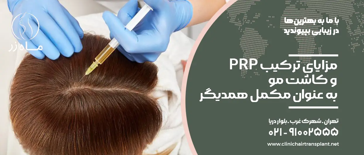 مزایای ترکیب PRP و کاشت مو