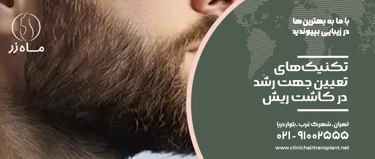 تکنیک‌های تعیین جهت رشد ریش