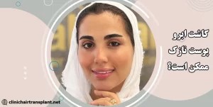 کاشت ابرو پوست نازک