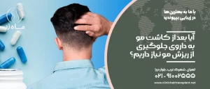 آیا بعد از کاشت مو به داروی جلوگیری از ریزش مو نیاز داریم؟