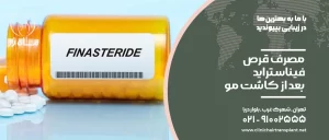 قرص فیناستراید بعد از کاشت مو