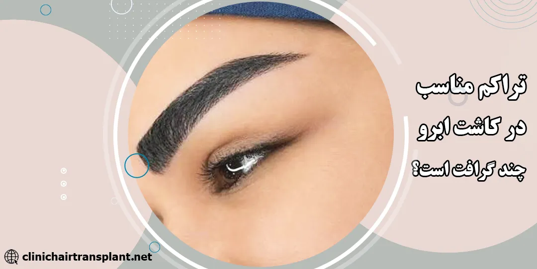 تراکم مناسب در کاشت ابرو چند گرافت است؟