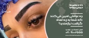 چه عواملی تعیین می‌کنند که شما به چه تعداد گرافت نیازمندید؟