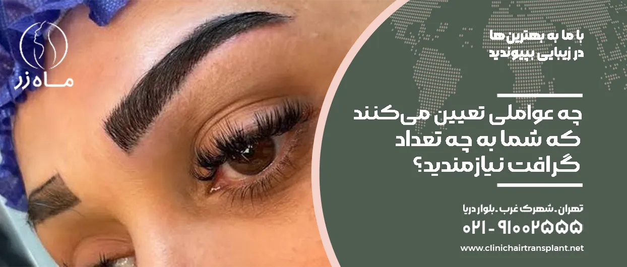 چه عواملی تعیین می‌کنند که شما به چه تعداد گرافت نیازمندید؟