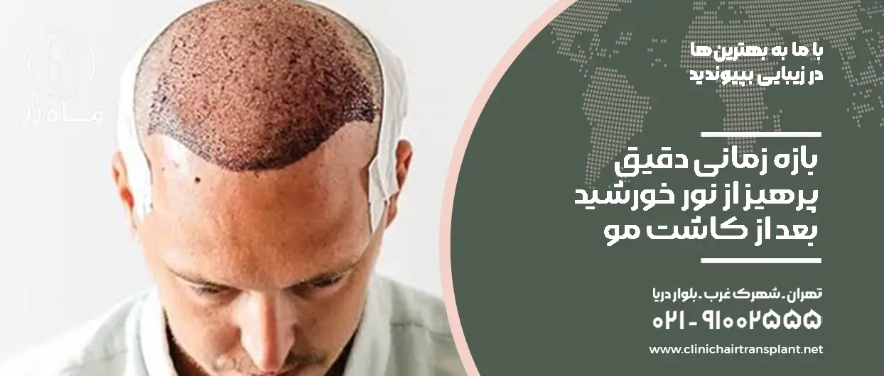 بازه زمانی دقیق پرهیز از نور خورشید بعد از کاشت مو