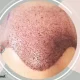 تفاوت گرافت و فولیکول در کاشت مو چیست؟